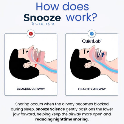 Snooze Science Anti-Snoring Mouthpiece
